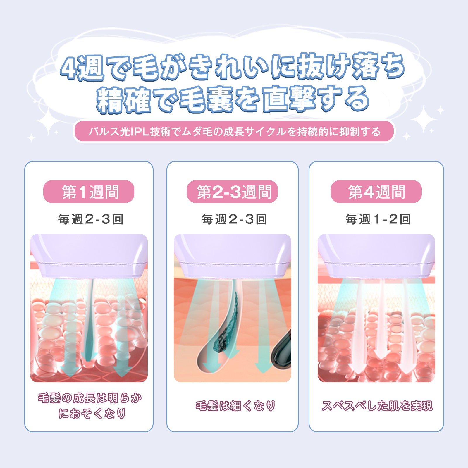 YETE IPL光脱毛 家庭用脱毛器 冷感無痛ケア VIO対応 無限照射回数 YETE 脱毛器 IPL光脱毛 家庭用脱毛器 冷感無痛ケア VIO対応