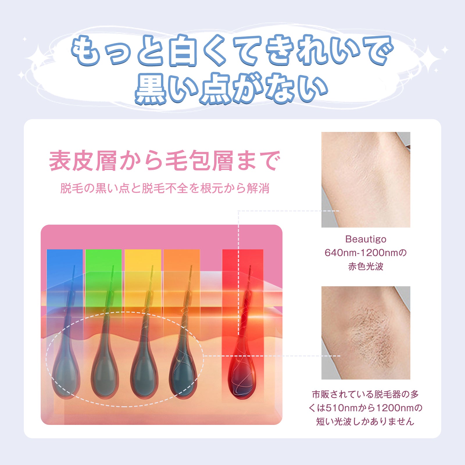 YETE 脱毛器 IPL光脱毛 家庭用脱毛器 冷感無痛ケア VIO対応