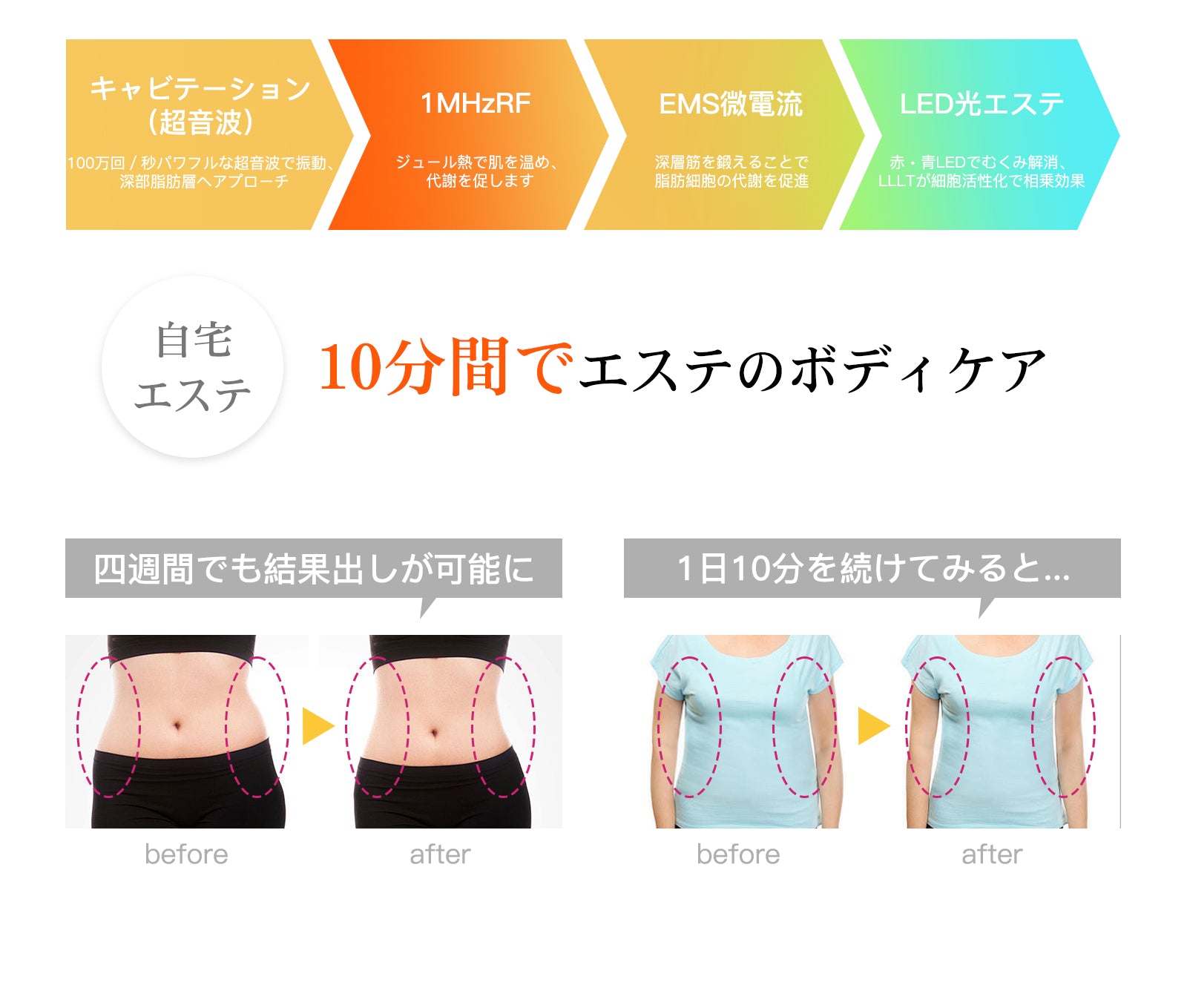 EMS 減量機器フィール超音波痩身美容デバイス – YETE