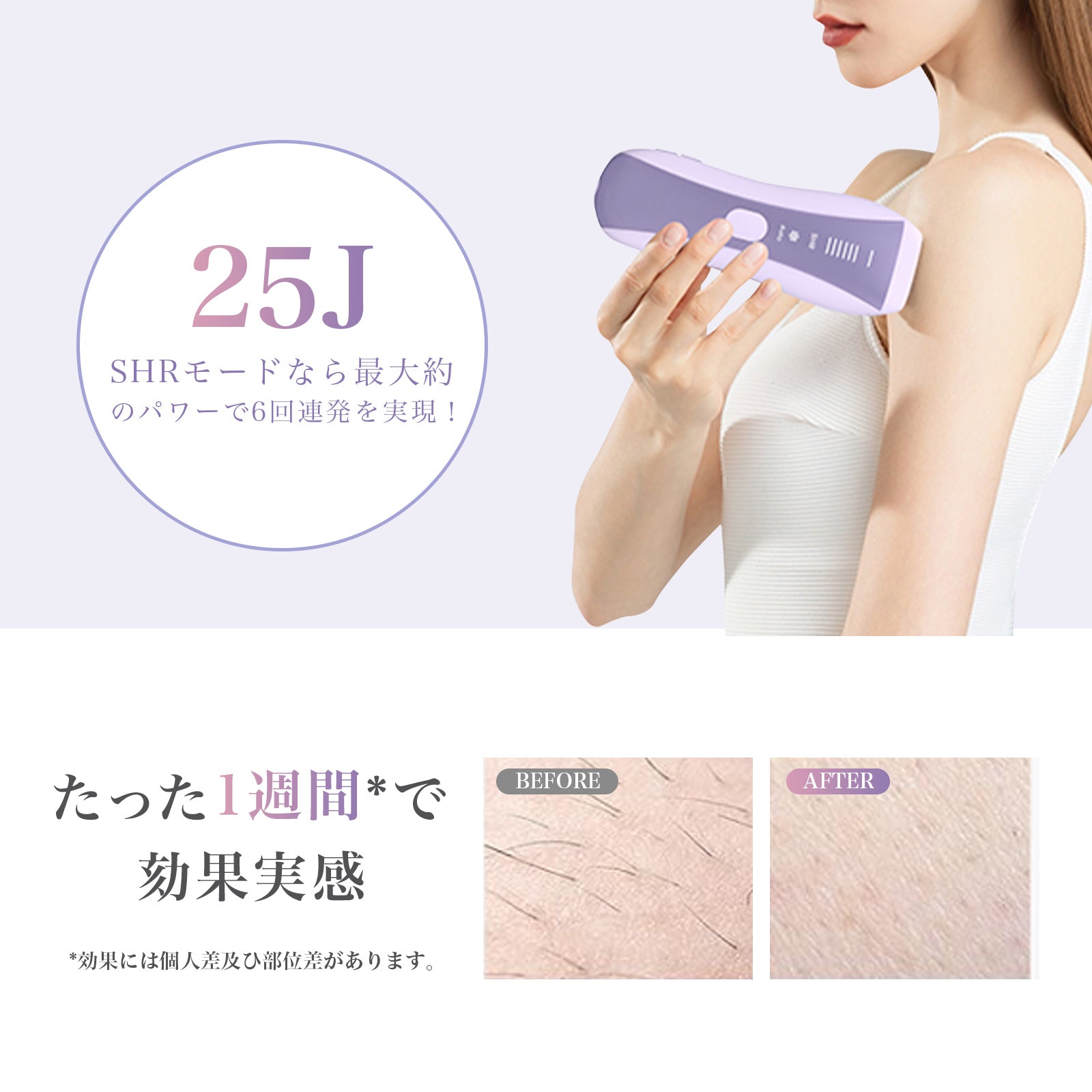 yete 脱毛器 IPL光脱毛 家庭用脱毛器 YETE 脱毛器 IPL光脱毛 家庭用脱毛器 冷感無痛ケア VIO対応
