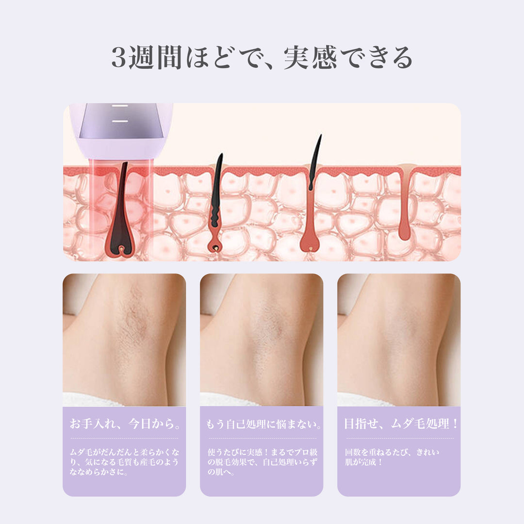 YETE 脱毛器  家庭用脱毛器 全身ムダ毛処理 IPL光脱毛器 家庭用 冷感無痛ケア 無痛設計 敏感肌対応 医療機器認証